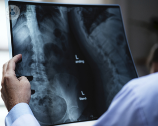 vetebras radiografia medico top doctors 