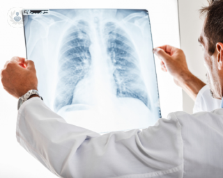 Cirugía de mínima invasión para cáncer de pulmón