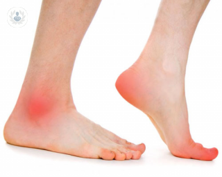 podologia deportiva tratamiento lesiones pie