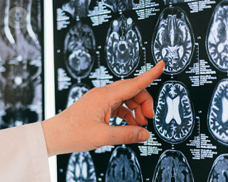 La detección temprana y el tratamiento adecuado son fundamentales en la lucha contra los tumores cerebrales