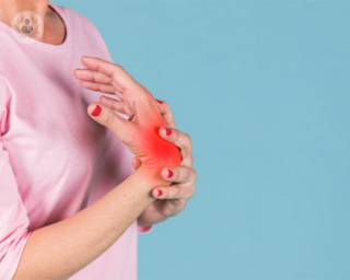 artritis mujer dolor topdoctors
