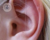 El doctor Emilio Cabrera nos explica qué es y qué cicatrices resultan de la otoplastia, una cirugía plástica mediante la cual se moldean las orejas. 