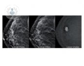 Imagen de una mamografía
