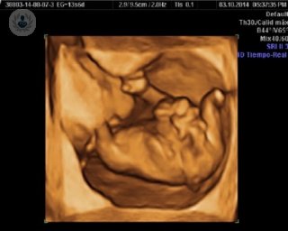 gastrosquisis fetal bebé