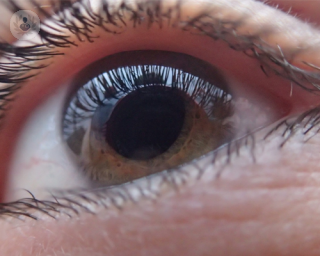 El glaucoma provoca un aumento de presión intraocular