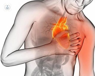 infarto agudo de miocardio