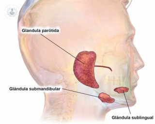 Qué supone la cirugía de glándulas salivales y por qué deben tratarse