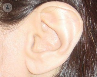 Operación de oído medio para tratar la otitis y la pérdida auditiva