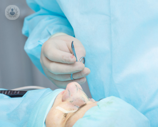 cirugia tecnica rinoplastia