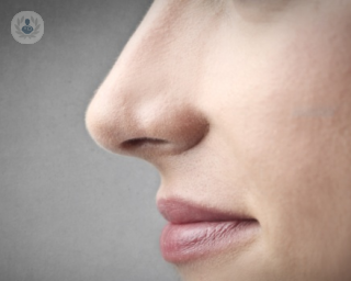 corregir nariz con rinoplastia