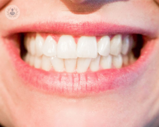dientes_tratamiento periodontico_boca_sonrisa