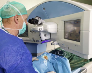 laser ocular para miopia, hipermetropia y astigmatismo