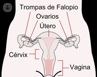El doctor Cristóbal García explica qué son los miomas uterinos y aclara los síntomas que presentan y el abanico de tratamientos. 