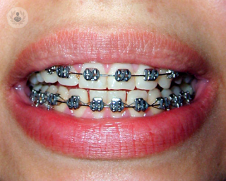 El Dr. José Ignacio Blasi Gutiérrez explica en este artículo los objetivos de la ortodoncia.