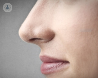 La rinoplastia es una técnica que se puede aplicar a corregir defectos de la nariz, una intervención mediante antestesia general, que obliga a llevar una férula en 7 días