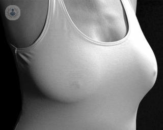 Una opción para los pechos son las mamas de aumento con grasa propia, por medio de una liposucción para subir una talla y reafirmarlos