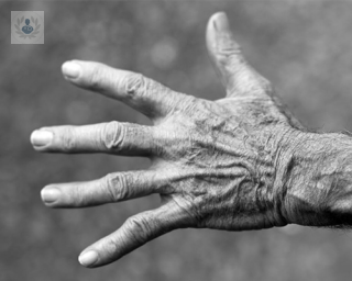 Las manos a menudo pueden sufrir lesiones por la actividad diaria. Descubre cuáles son las existentes y cómo se realiza la cirugía de la mano.