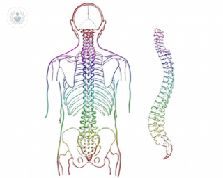 Qué son las malformaciones vasculares espinales