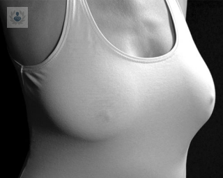 duración prótesis mamarias