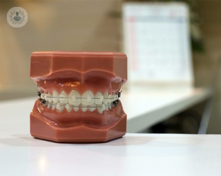 Beneficios de los tipos de ortodoncia Top Doctors