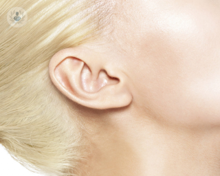 oreja, mujer, otoplastia, femenina, cirugia