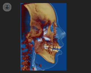 La cirugía ortognática permite corregir la posición de los maxilares
