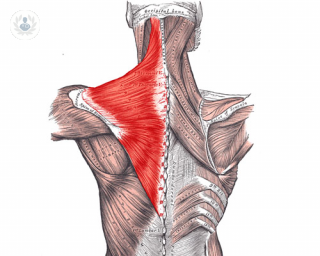 Los dolores cervicales que impiden mover el cuello y el brazo pueden deberse a una trapezalgia