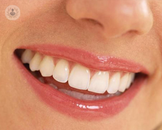 El color de nuestros dientes se determina por la dentina, tejido que se encuentra entre la pulpa y el esmalte