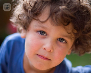 Diez consejos para controlar, cuidar y tratar la dermatitis atópica en niños