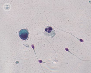 espermatozoide inseminacion fecundacion esterilidad