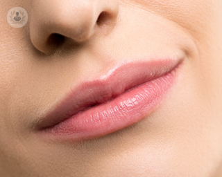Con el aumento de labios muchas personas buscan mejorar su imagen y autoestima