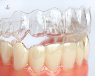 ortodoncia para mejorar su salud bucodental