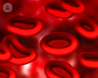 anemia, hematologia, sangre