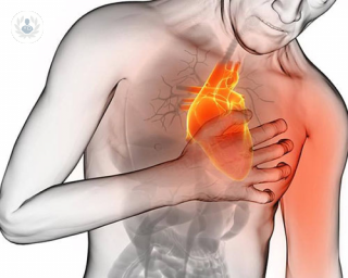 sintomas de alerta de infarto | Top Doctors