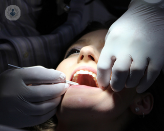 Cuidados tras implantes dentales
