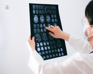 Las principal enfermdad asociada con el deteriodo cognitivo es el Alzheimer