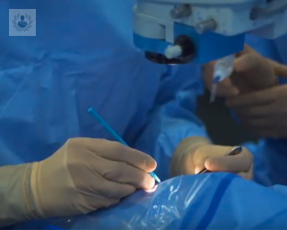 trasplante de cornea tecnicas selectivas operación oftalmologo topdoctors