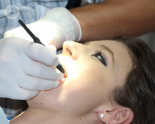 implantes_dentales_sonrisa_mujer