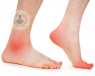podologia deportiva tratamiento lesiones pie