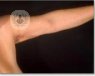 Se puede mejorar la imagen de brazos y manos a través de unas sencillas técnicas de medicina estética