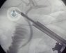 La endoscopia craneal permite ver y manipular las regiones profundas del sistema nervioso con un mínimo riesgo para el paciente.