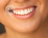 ¿Sabías que la Estética Dental permite resolver problemas bucales y de armonía estética de la sonrisa? La Dra. Galera te informa