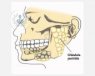 La glándula parótida genera saliva y la libera directamente en la boca. El Dr. Espinosa te informa sobre sus patologías y tratamientos.