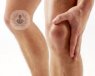 La cirugía guiada de prótesis de rodilla se aconseja a cualquier paciente con un desgaste en la rodilla