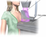 Tecnica mamografia