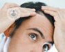 ¿Sufres algún tipo de alopecia o calvície incipiente? Conoce todos los detalles en este artículo.