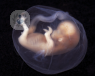 Detecta si el embrión en cuestión es portador de una enfermedad genética