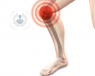 La artrosis de rodilla se caracteriza por un dolor de carácter mecánico