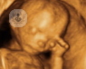 Las ecografías 4d permiten ver al bebé con todo tipo de detalles y todas sus expresiones. Conlleva poco peligro para mujer y bebé, por lo que están en alza.