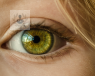 El ojo vago o ambliopía es una pérdida parcial de la visión con distintos grados. Las causas pueden ser otras patologías de la visión como estrabismo o cataratas.